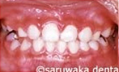ortho_case1_af