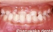 ortho_case1_be