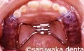 ortho_case1_so