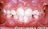 ortho_case2_af