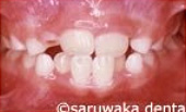 ortho_case2_be