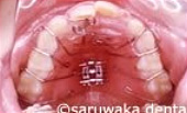 ortho_case2_so