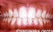 ortho_case3_af