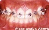 ortho_case3_be