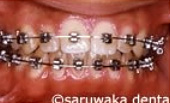 ortho_case3_so