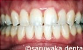 ortho_case4_af
