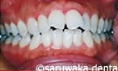 ortho_case4_be