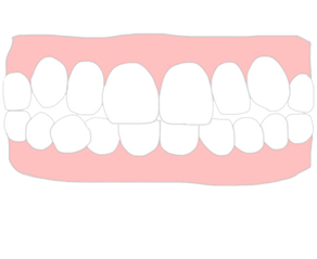 歯並び