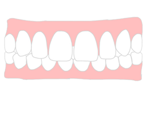 歯並び