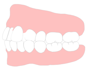 歯並び