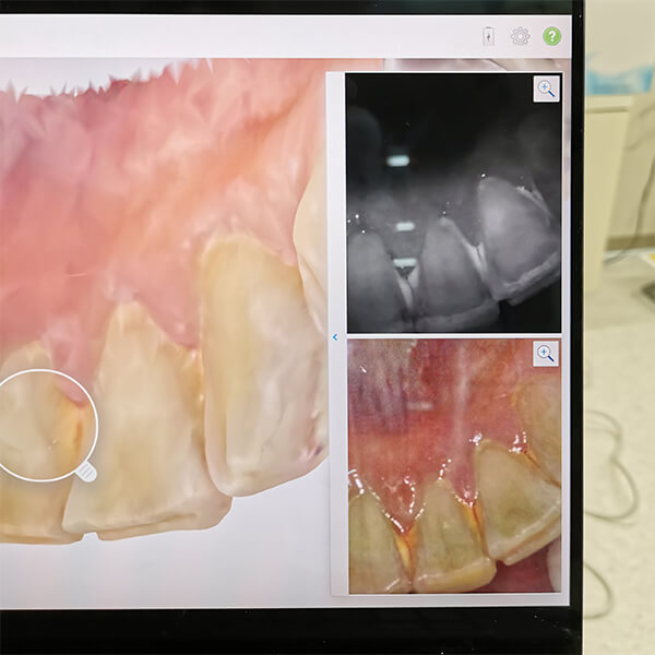 虫歯や歯石なども細かくチェックすることができます