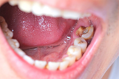 歯のみためについてこんな悩みはありませんか？